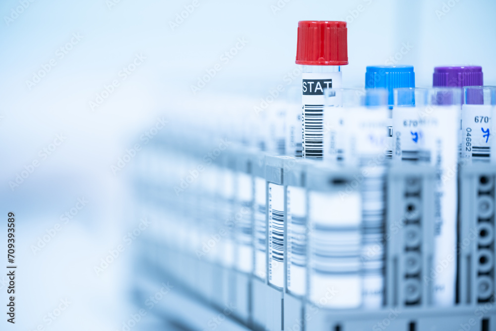 Blood test tube isolated and barcode label on white background.Laboratory medical concept.Technician and blood test tube at lalaboratory unit.