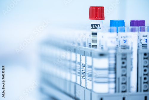 Blood test tube isolated and barcode label on white background.Laboratory medical concept.Technician and blood test tube at lalaboratory unit. photo