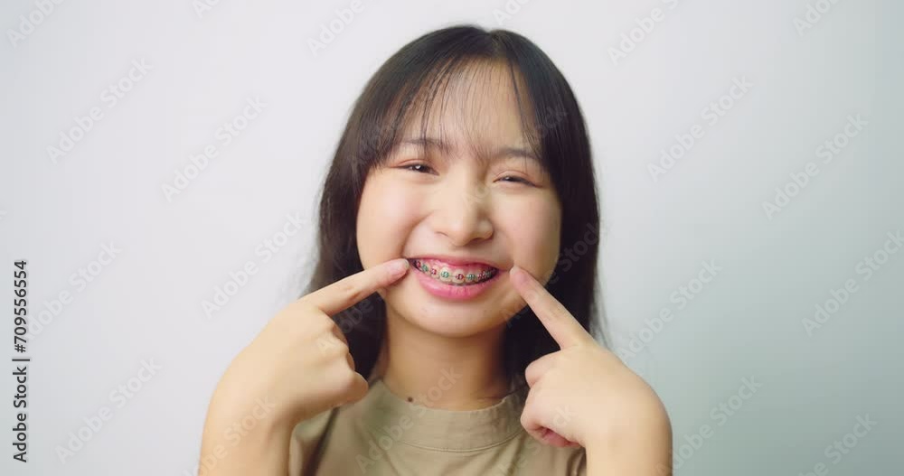 Happy beautiful asian girl with braces. She looking to camera with attractive smiling at white background. Happy beautiful asian girl with braces. She looking to camera with attractive smiling at white background.