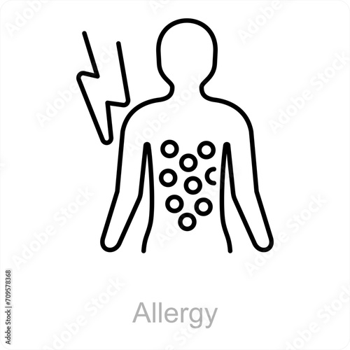 Allergy