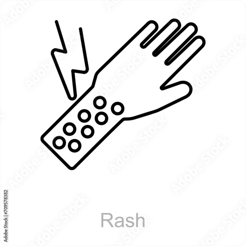 Rash