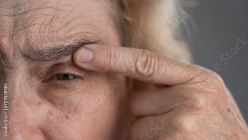 Close-up portrait of an old woman pointing at a wrinkle on her upper eyelid.  photo
