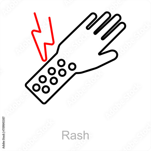 Rash
