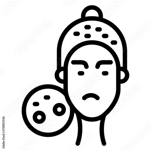 Seborrheic Dermatitis icon vector image. Can be used for Dermatology.