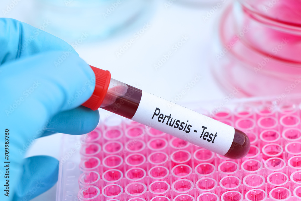 Pertussis test to look for abnormalities from blood Pertussis test to look for abnormalities from blood