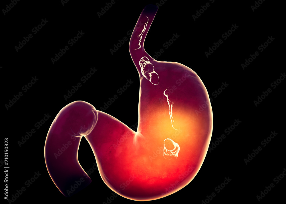 Food path and digestion, passage of food through the stomach, digestive