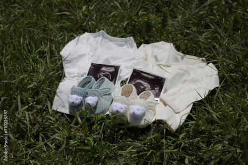 congratulating pregnancy with twins