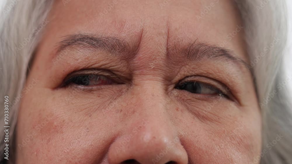 The eyes of an elderly Asian woman who looks worried, thinks too much, and is uncomfortable. Eye problems in the elderly. Close-up view The eyes of an elderly Asian woman who looks worried, thinks too much, and is uncomfortable. Eye problems in the elderly. Close-up view