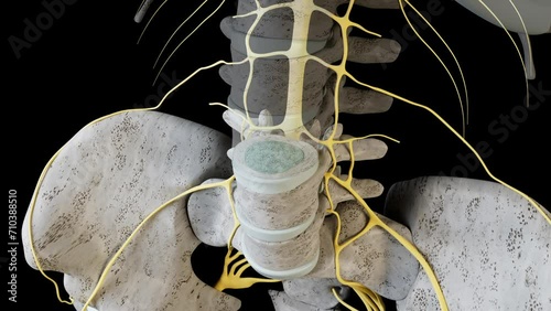 Bulging Disc Overview