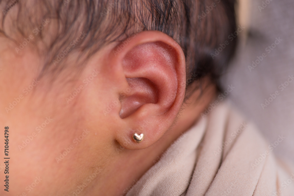 Naklejka premium Little newborn baby earlobe earring ear preauricular appendix listen