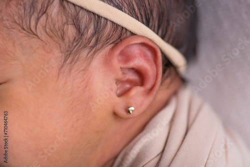 Obraz na plátně Little newborn baby earlobe earring ear preauricular appendix listen