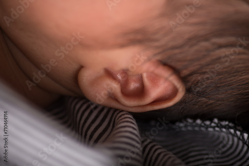 Little newborn baby earlobe earring ear preauricular appendix listen photo