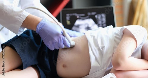 Child undergoing ultrasound to determine position of kidney stones before lithotripsy procedure. Ultrasound of internal organs in children concept photo