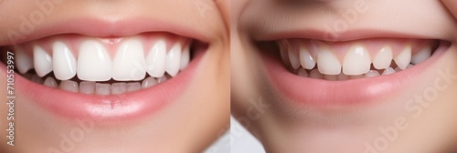 Children s white teeth