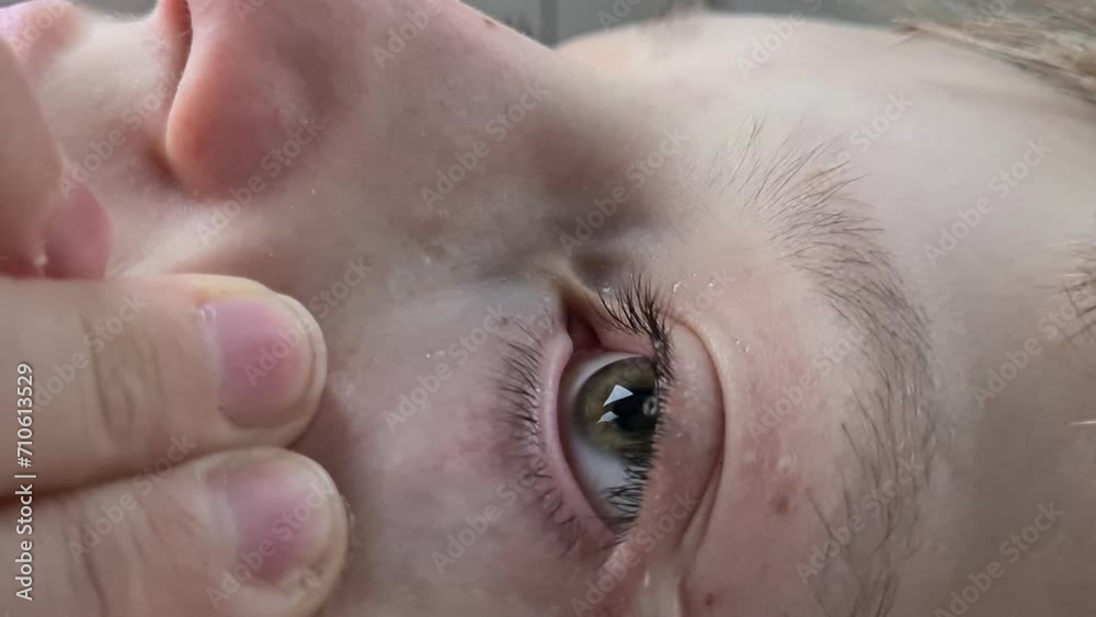 Child hand drips eye drops into eyes. Treatment and the problem of allergic conjunctivitis and eye disease Child hand drips eye drops into eyes. Treatment and the problem of allergic conjunctivitis and eye disease