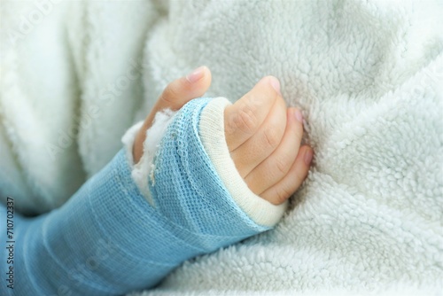 Children hand bone broken from accident with arm splint