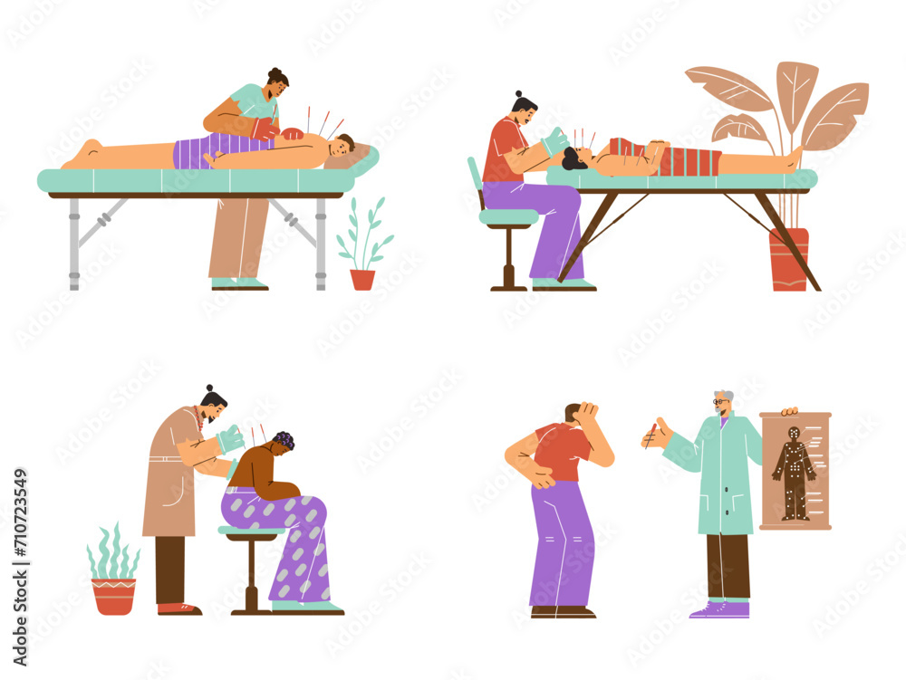 Naklejka premium Acupuncture treatment vector set, acupuncturist inserts needles in the patient's face or back, alternative medicine