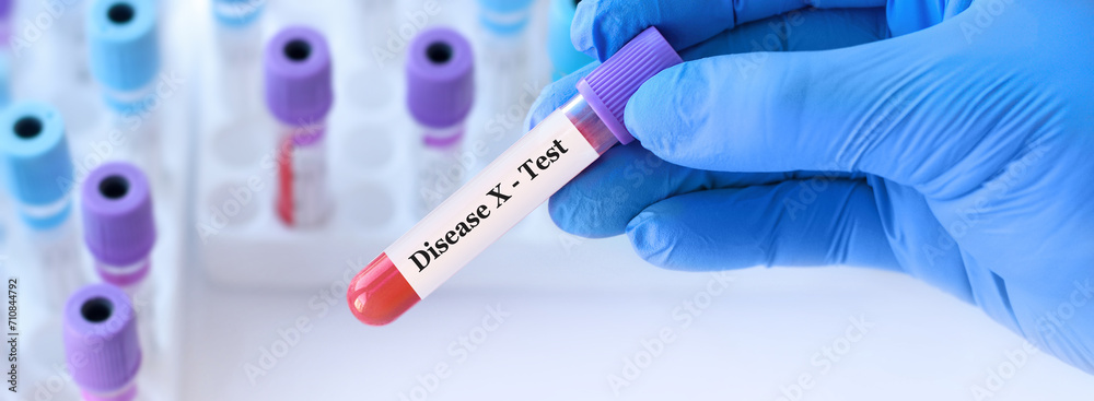 Fototapeta premium Doctor holding a test blood sample tube with Disease X test.The world is preparing for a new mysterious pandemic 