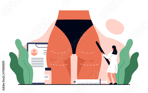 Gluteoplasty procedure. Buttock augmentation, surgery: buttock implants or fat grafting. Surgical correction concept. Vector illustration in cartoon style. Isolated on white background.