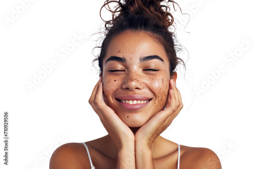 Portrait of young beautiful woman with scar or acne on face skin isolated on white transparent background. photo