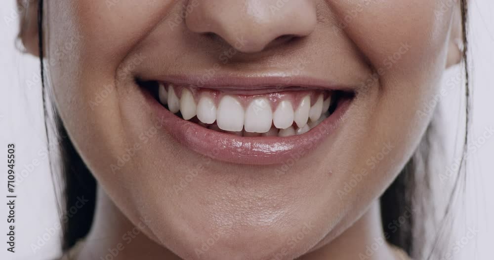 Smile, person and teeth whitening with closeup of mouth, orthodontics and wellness for oral health on white background. Dental, veneers and happy in studio, hygiene and grooming with fresh breath Smile, person and teeth whitening with closeup of mouth, orthodontics and wellness for oral health on white background. Dental, veneers and happy in studio, hygiene and grooming with fresh breath