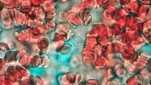 Human Red Blood Cells with White Blood Cell in the Center under the microscope at 1000x magnification 