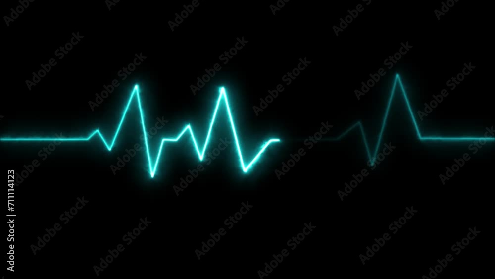 Abstract heartbeat and pulse rate signal technology animation background Abstract heartbeat and pulse rate signal technology animation background