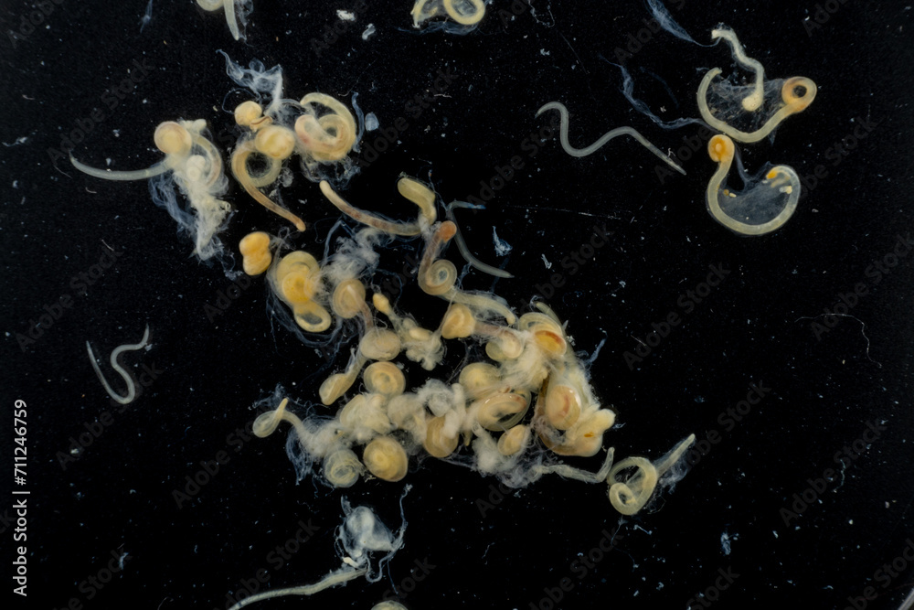 Study of Parasitic helminths (Trematodes) and Ascaris of fishes under a microscope. Study of Parasitic helminths (Trematodes) and Ascaris of fishes under a microscope.