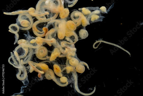Study of Parasitic helminths (Trematodes) and Ascaris of fishes under a microscope. photo