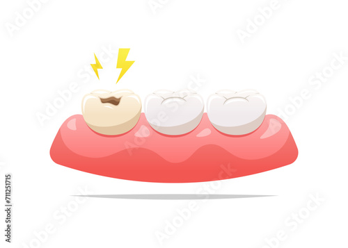 painful cavities on gum. Dental health concept. Vector illustration.