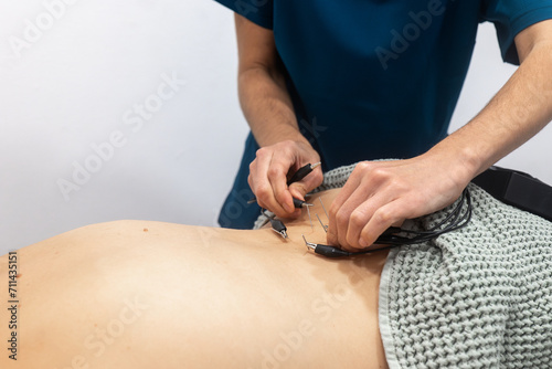 Electrocardiogram electrode placement by a healthcare professional