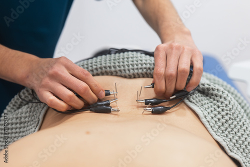 Close-up of ECG electrode placement on patient's chest photo