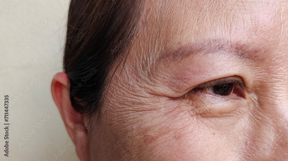 Obraz premium Portrait showing the wrinkles and flabby skin beside the eyelid, dark spots and blemish on the face of the woman, health care and beauty concept.