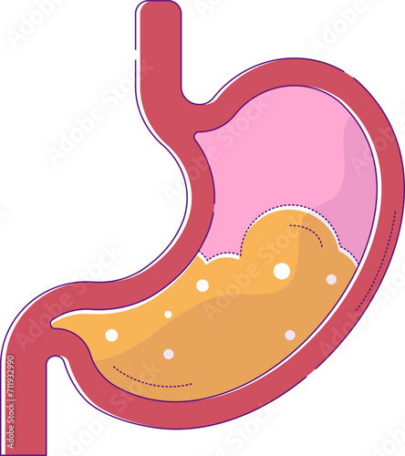 Flat design of a human stomach with gastric juice, internal organ digestion concept. Stomach anatomy, health, and medicine vector illustration.