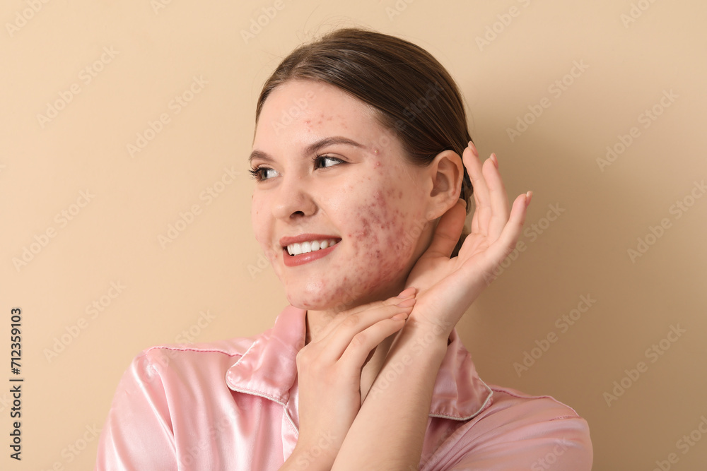 Young woman with acne problem on beige background, closeup Young woman with acne problem on beige background, closeup