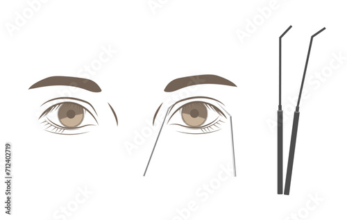 プジーを使った二重のシミュレーション