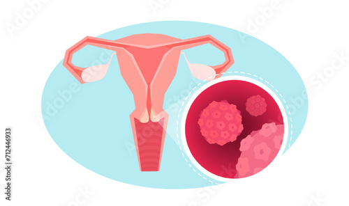 an uterus, fallopian tubes and ovaries