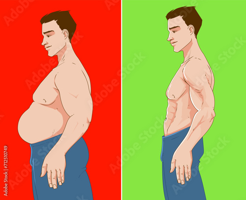 A man's body with belly fat. Before, after. Healthcare illustration. Vector illustration. 