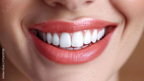 Healthy white teeth and pink gum of a woman, beautiful smile. Dental care concept