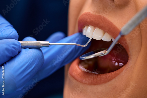 Close up of woman having teeth examination at dentist s office.