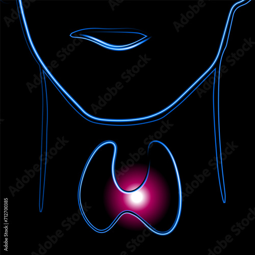 Vector isolated illustration of thyroid gland with neon effect. Enlarged thyroid gland.