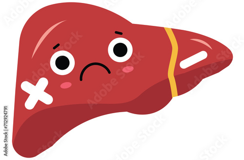 liver, cirrhosis disease. Human liver organ anatomy vector illustration on white background.Stage Of liver Disease Concept,Unhealthy Liver,Cirrhosis Medical Education,sad,red,yellow