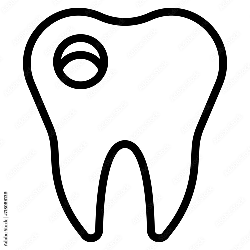 cavity cavity