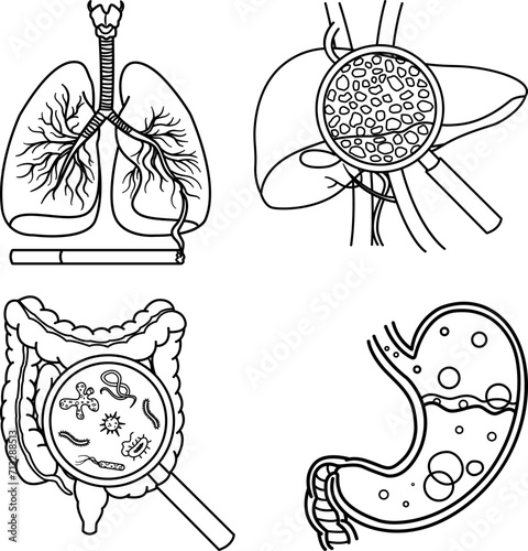 Anatomy of Human Organs with Various Diseases for Coloring. Vector Illustration of Smoker's Lungs, Liver Hepatitis, Intestinal Virus, and Indigestion. Medicine Concept