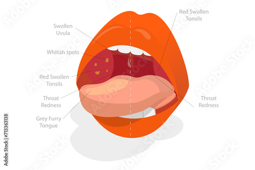 3D Isometric Flat  Conceptual Illustration of Parts Of Human Mouth, Educational Diagram photo