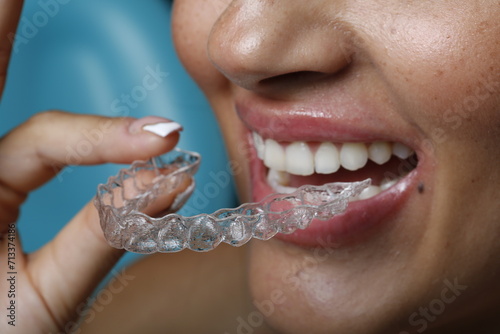 invisible orthodontic smile	
