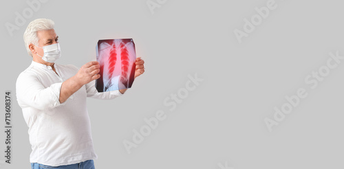 Senior man holding x-ray im...