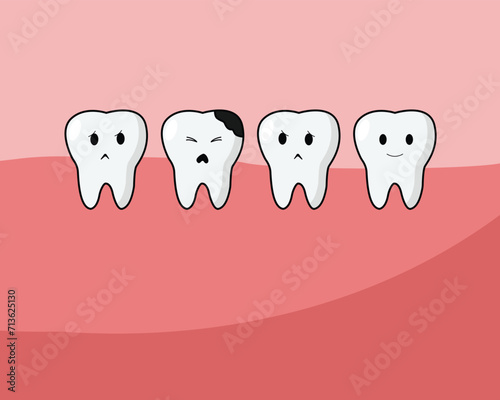 Toothache illustration: damaged tooth, black hole, tingling while eating. Seek prompt treatment to prevent further damage