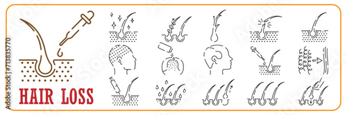 Treatment and Problem of Hair. Hair Beauty Care Line Icon set. Hair Care and Loss Problem. Cosmetic Products for Hairstyle Color Outline Icons. Isolated Vector Illustration