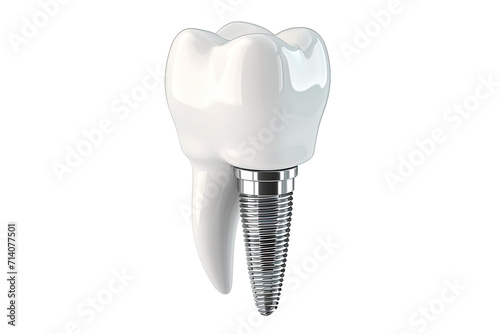 Implants and dental bridge with for installation and preserves isolated on transparent png background, fake teeth in dentistry, medicine and prosthesis.